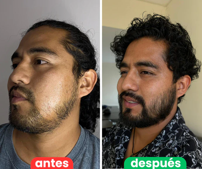 apolo. | Estimulante de Barba Apolo | Dispierta la barba que ya existe en ti. | Oferta 2x1