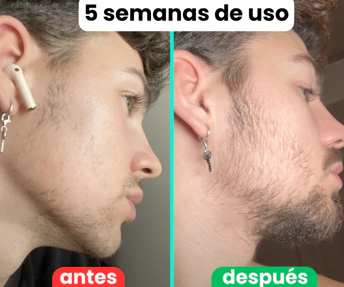 apolo. | Estimulante de Barba Apolo | Dispierta la barba que ya existe en ti. | Oferta 2x1