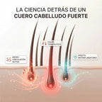 CapilRoot Pro - Activa el crecimiento capilar desde la primera sesión ⚠️ Últimas unidades disponibles
