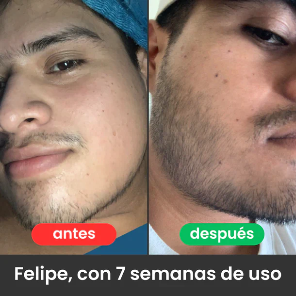apolo. | Estimulante de Barba Apolo | Dispierta la barba que ya existe en ti. | Oferta 2x1